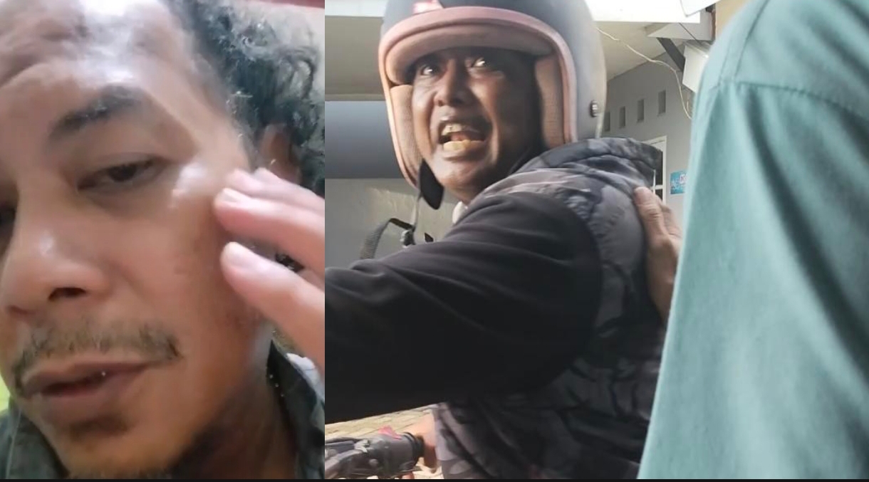 Sholeh Sibali perlihatkan memar akibat dugaan penganiayaan, dan yang makai helm diduga pelaku penganiayaan. (Foto: Dok. Int)